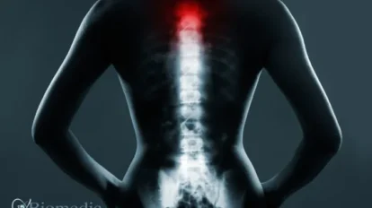 Mal di schiena arriva la nuova tecnologia 3D senza radiazioni